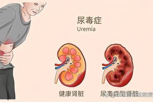 多特vs斯图加特首发：穆科科、阿德耶米先发，吉拉西出战